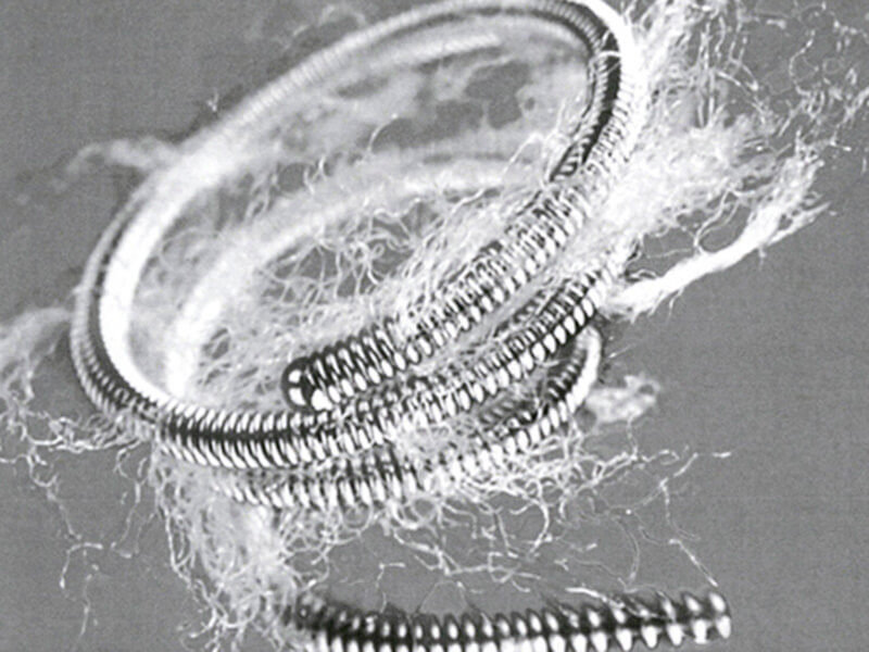 Stainless Steel Occluding Embolus (1975)