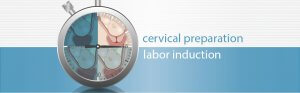 Cervical preparation vs. labor induction