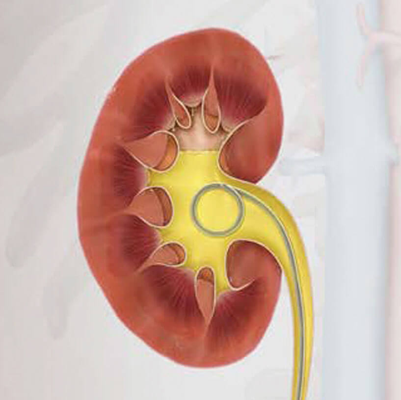 Urology Contracting Cook Medical