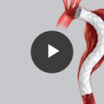 Alpha Thoracic Animation