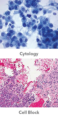 cytology-and-cell-block