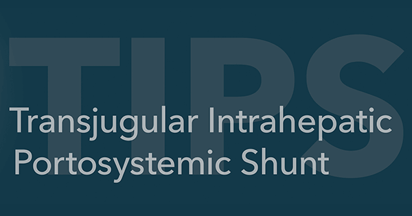 Tips Dips Radiology Educational video series: TIPS procedures | Cook Medical
