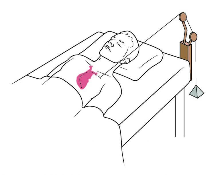 Lead Extraction from dark art to standard procedure Lead Management